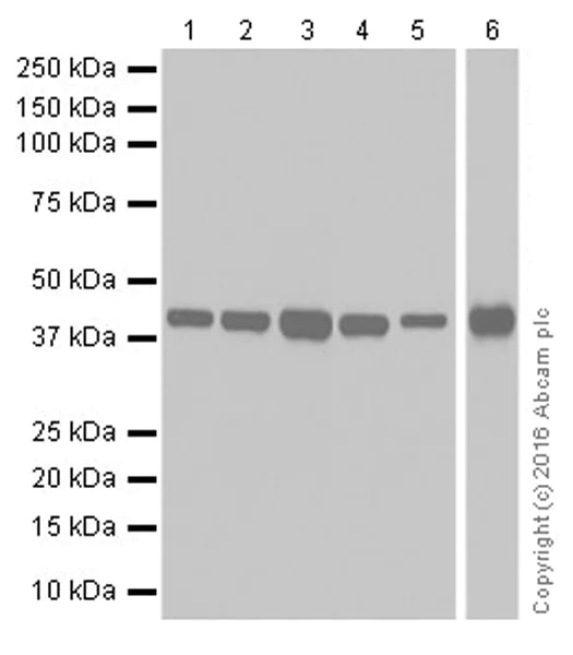 Western blot - Anti-PDK1 antibody [EPR19573] (AB207450)