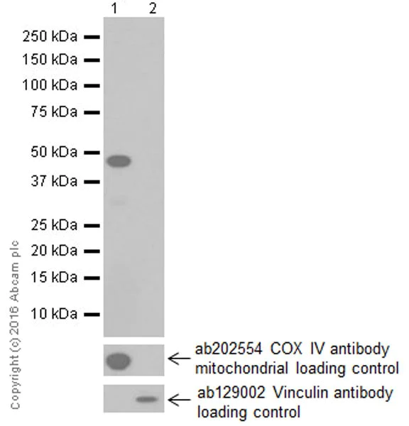 Western blot - Anti-PDK1 antibody [EPR19573] (AB207450)