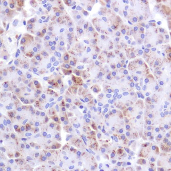 Immunohistochemistry (Formalin/PFA-fixed paraffin-embedded sections) - Anti-PDK1 antibody [SP270] - BSA and Azide free (AB326584)