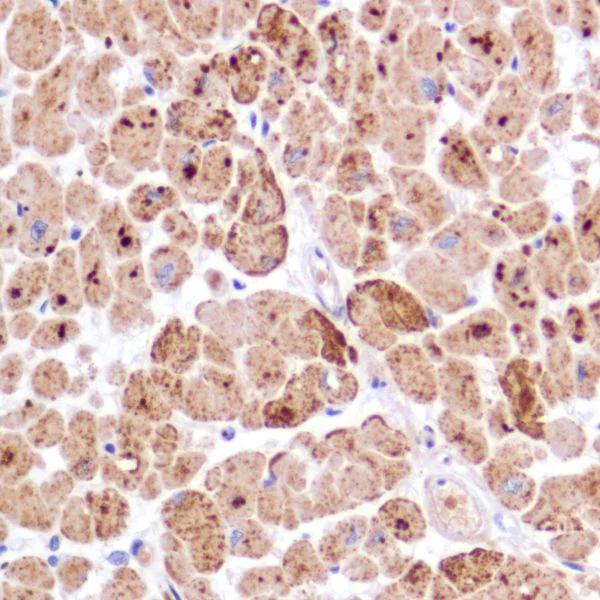 Immunohistochemistry (Formalin/PFA-fixed paraffin-embedded sections) - Anti-PDK1 antibody [SP270] - BSA and Azide free (AB326584)