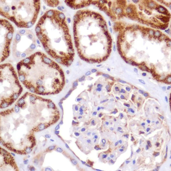 Immunohistochemistry (Formalin/PFA-fixed paraffin-embedded sections) - Anti-PDK1 antibody [SP270] - BSA and Azide free (AB326584)