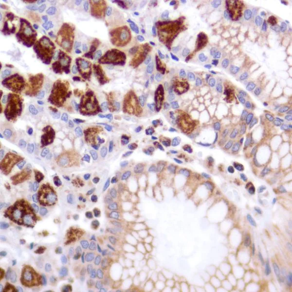Immunohistochemistry (Formalin/PFA-fixed paraffin-embedded sections) - Anti-PDK1 antibody [SP270] - BSA and Azide free (AB326584)