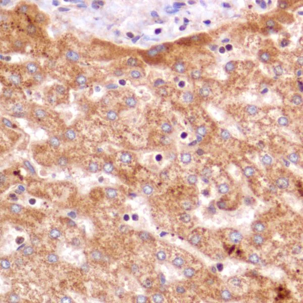 Immunohistochemistry (Formalin/PFA-fixed paraffin-embedded sections) - Anti-PDK1 antibody [SP270] - BSA and Azide free (AB326584)