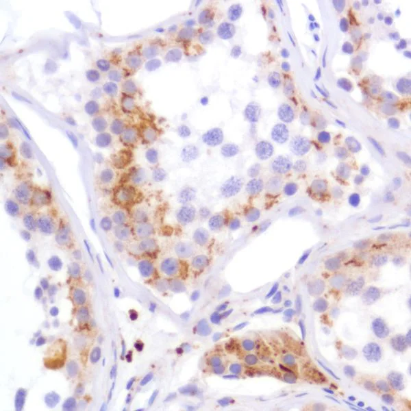 Immunohistochemistry (Formalin/PFA-fixed paraffin-embedded sections) - Anti-PDK1 antibody [SP270] - BSA and Azide free (AB326584)