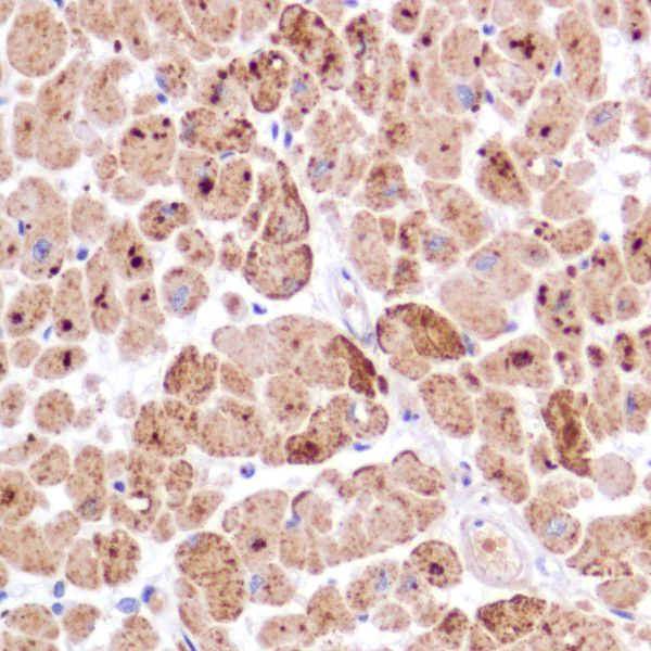 Immunohistochemistry (Formalin/PFA-fixed paraffin-embedded sections) - Anti-PDK1 antibody [SP270] - C-terminal (AB227682)