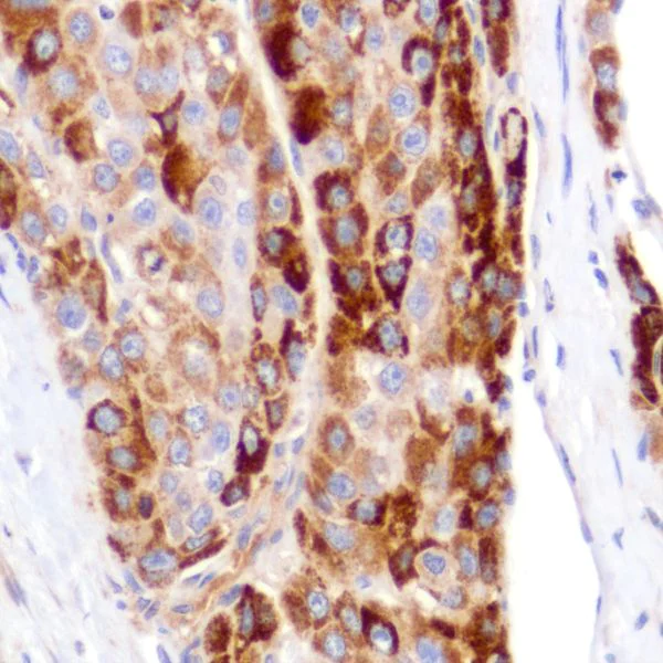 Immunohistochemistry (Formalin/PFA-fixed paraffin-embedded sections) - Anti-PDK1 antibody [SP270] - C-terminal (AB227682)