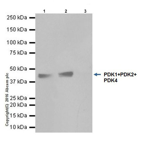 Immunoprecipitation - Anti-PDK1 + PDK2 + PDK4 antibody [EPR19727] (AB208187), expandable thumbnail