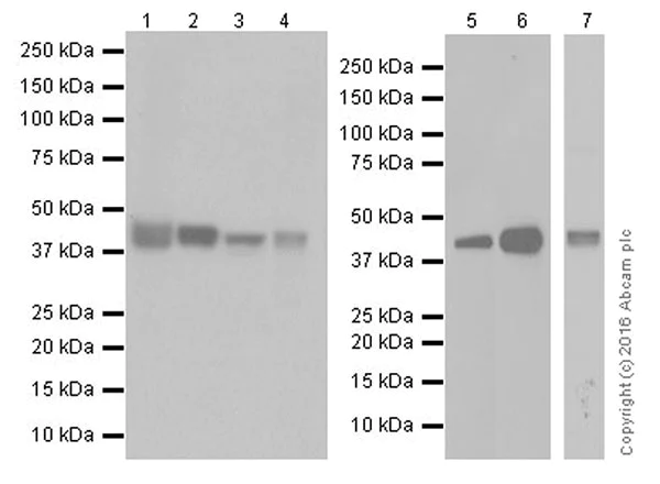 Western blot - Anti-PDK1 + PDK2 + PDK4 antibody [EPR19727] - BSA and Azide free (AB251492)