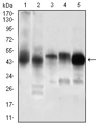Western blot - Anti-PDK2 antibody [3F2D7] (AB201964)