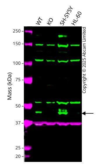 Western blot - Anti-PDK2 antibody [3F2D7] (AB201964)
