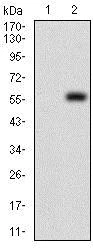 Western blot - Anti-PDK2 antibody [3F2D7] (AB201964)