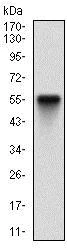 Western blot - Anti-PDK2 antibody [3F2D7] (AB201964)