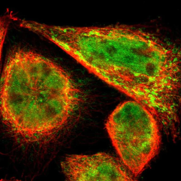 Immunocytochemistry/ Immunofluorescence - Anti-PDK2 antibody (AB246888)