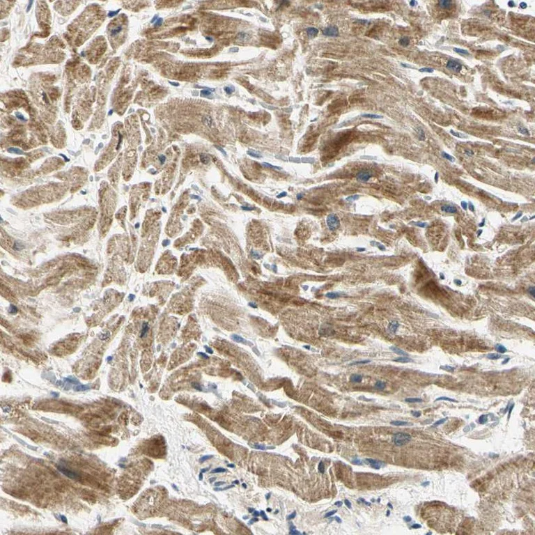 Immunohistochemistry (Formalin/PFA-fixed paraffin-embedded sections) - Anti-PDK2 antibody (AB246888)