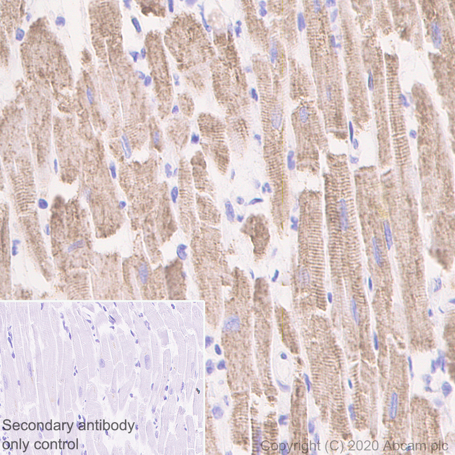 Immunohistochemistry (Formalin/PFA-fixed paraffin-embedded sections) - Anti-PDK2 antibody [EPR1948Y] (AB68164)