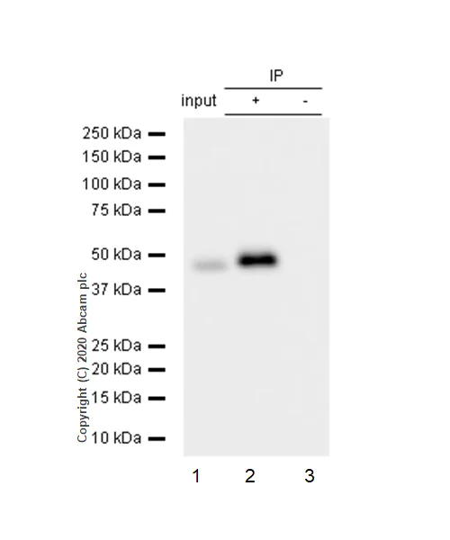 Immunoprecipitation - Anti-PDK2 antibody [EPR1948Y] - BSA and Azide free (AB227847)