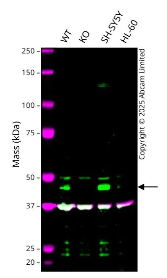 Western blot - Anti-PDK2 antibody [EPR1948Y] - BSA and Azide free (AB227847)