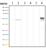 Western blot - Anti-PDK4 antibody [1C2BG5] (AB110336)