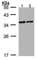 Western blot - Anti-PDLIM1/CLP36 antibody - C-terminal (AB228714)