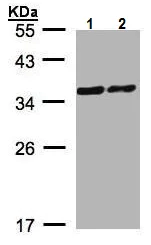 Western blot - Anti-PDLIM1/CLP36 antibody - C-terminal (AB228714)