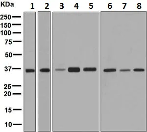 Western blot - Anti-PDLIM1/CLP36 antibody [EPR7186(B)] (AB129015)