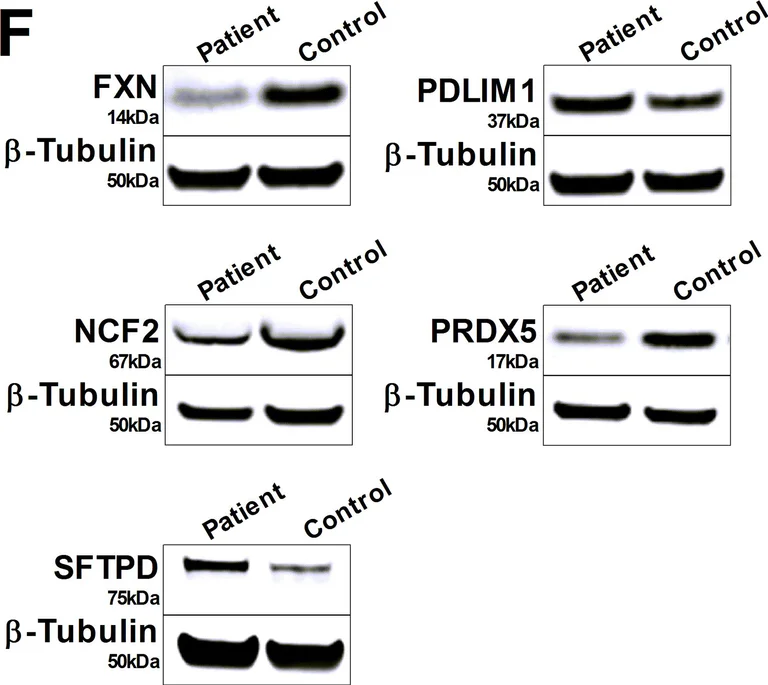 Western blot - Anti-PDLIM1/CLP36 antibody [EPR7187] (AB126628)