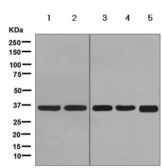 Western blot - Anti-PDLIM1/CLP36 antibody [EPR7187] - BSA and Azide free (AB248135), expandable thumbnail