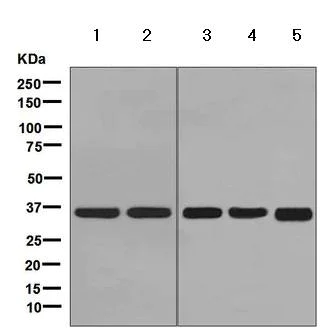 Western blot - Anti-PDLIM1/CLP36 antibody [EPR7187] - BSA and Azide free (AB248135)