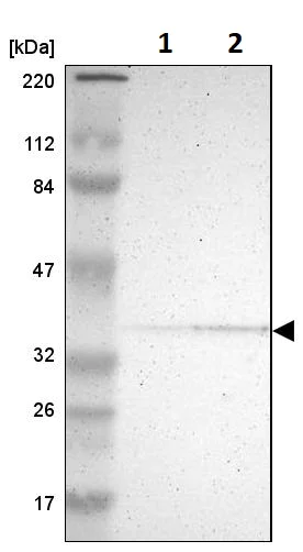 Western blot - Anti-PDLIM2 antibody (AB246868)