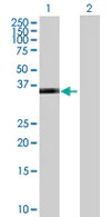 Western blot - Anti-PDLIM2 antibody (AB68220)
