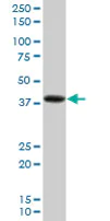 Western blot - Anti-PDLIM2 antibody (AB68220)