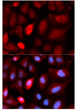 Immunocytochemistry/ Immunofluorescence - Anti-PDLIM5/ENH antibody (AB196559)