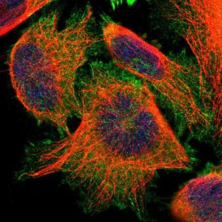 Immunocytochemistry/ Immunofluorescence - Anti-PDLIM5/ENH antibody (AB224385)