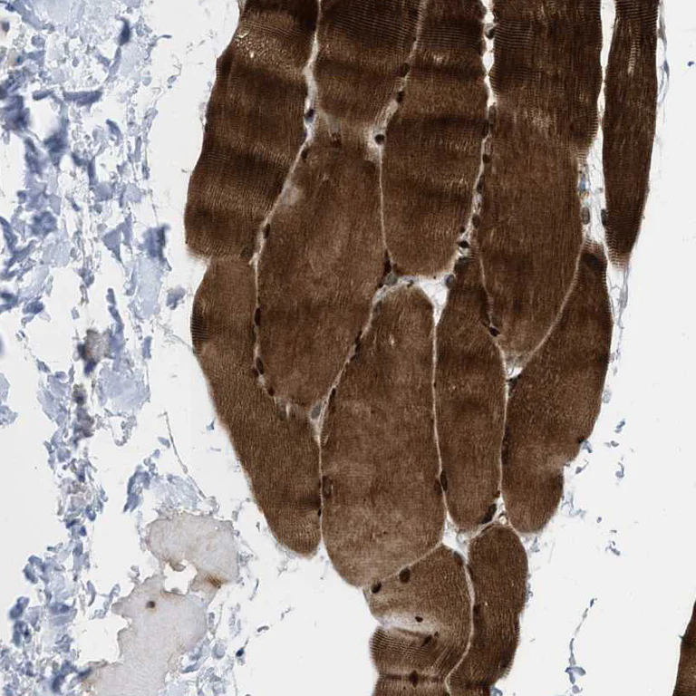 Immunohistochemistry (Formalin/PFA-fixed paraffin-embedded sections) - Anti-PDLIM5/ENH antibody (AB224385)