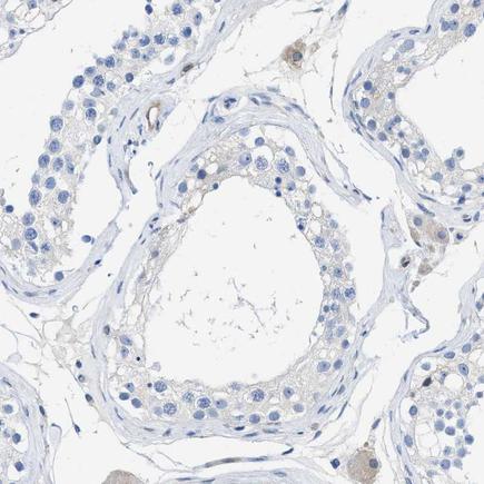Immunohistochemistry (Formalin/PFA-fixed paraffin-embedded sections) - Anti-PDLIM5/ENH antibody (AB224385)