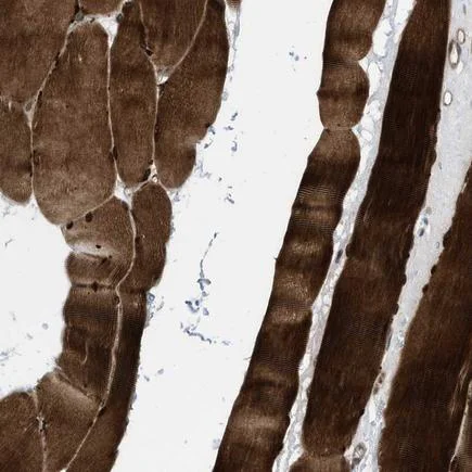 Immunohistochemistry (Formalin/PFA-fixed paraffin-embedded sections) - Anti-PDLIM5/ENH antibody (AB224385)