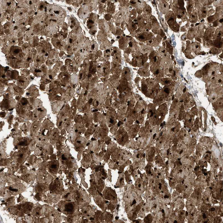 Immunohistochemistry (Formalin/PFA-fixed paraffin-embedded sections) - Anti-PDLIM5/ENH antibody (AB224385)