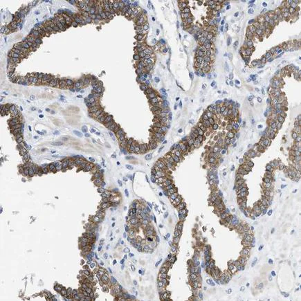 Immunohistochemistry (Formalin/PFA-fixed paraffin-embedded sections) - Anti-PDLIM5/ENH antibody (AB224385)