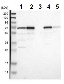 Western blot - Anti-PDLIM5/ENH antibody (AB224385)