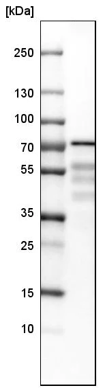 Western blot - Anti-PDLIM5/ENH antibody (AB224385)