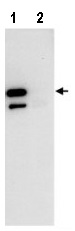 Immunoprecipitation - Anti-PDLIM5/ENH antibody (AB85967)