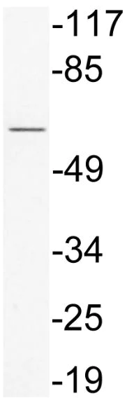 Western blot - Anti-PDLIM5/ENH (phospho Y251) antibody (AB138402)