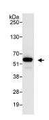 Immunoprecipitation - Anti-PDLIM7 antibody (AB86065)