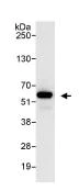 Immunoprecipitation - Anti-PDLIM7 antibody (AB86065)