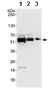 Western blot - Anti-PDLIM7 antibody (AB86065)