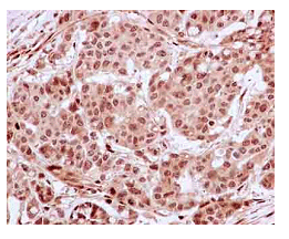 Immunohistochemistry (Formalin/PFA-fixed paraffin-embedded sections) - Anti-PDLIM7 antibody [EPR13171] (AB182153), expandable thumbnail