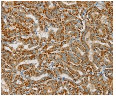 Immunohistochemistry (Formalin/PFA-fixed paraffin-embedded sections) - Anti-PDP1/PDP antibody (AB198261)