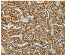 Immunohistochemistry (Formalin/PFA-fixed paraffin-embedded sections) - Anti-PDP1/PDP antibody (AB198261)