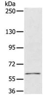 Western blot - Anti-PDP1/PDP antibody (AB198261)