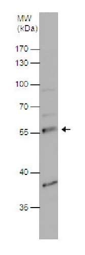 Western blot - Anti-PDP1/PDP antibody (AB228578)